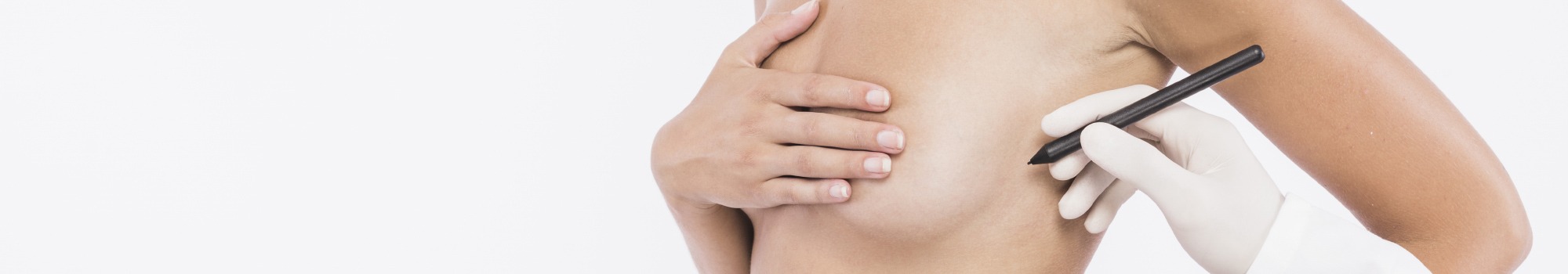 mamilo invertido mamoplastia aumento