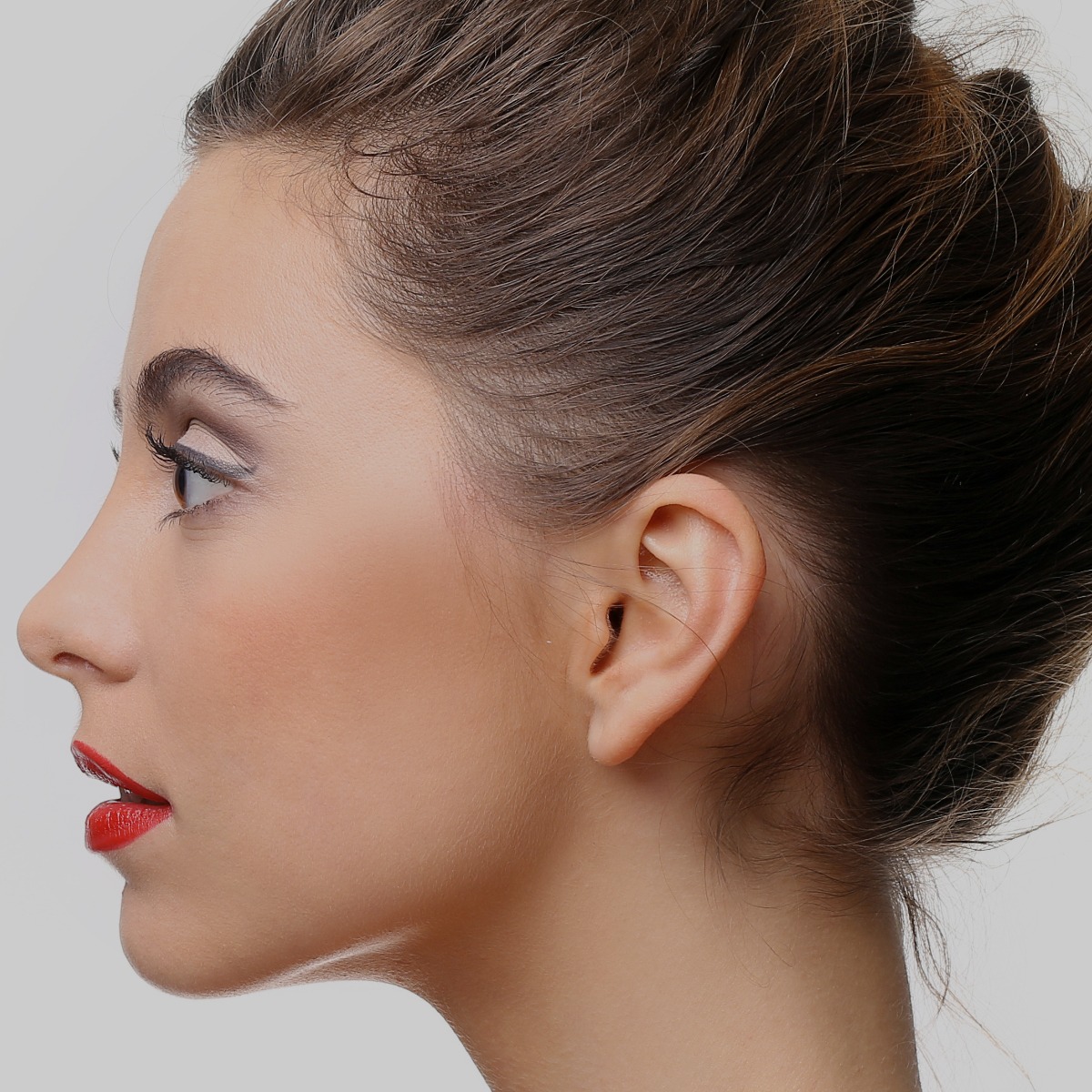 Otoplastia Operação às orelhas