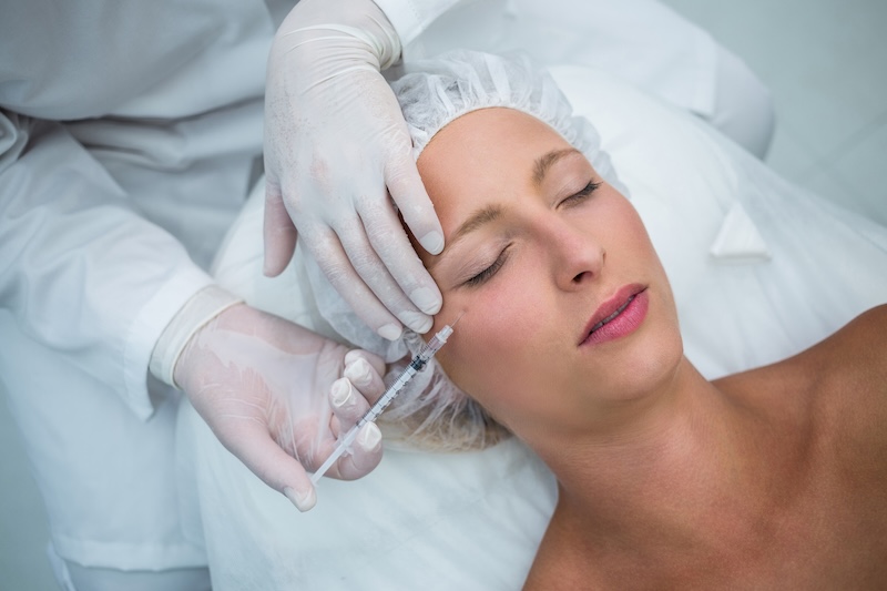 sculptra transpiração excessiva